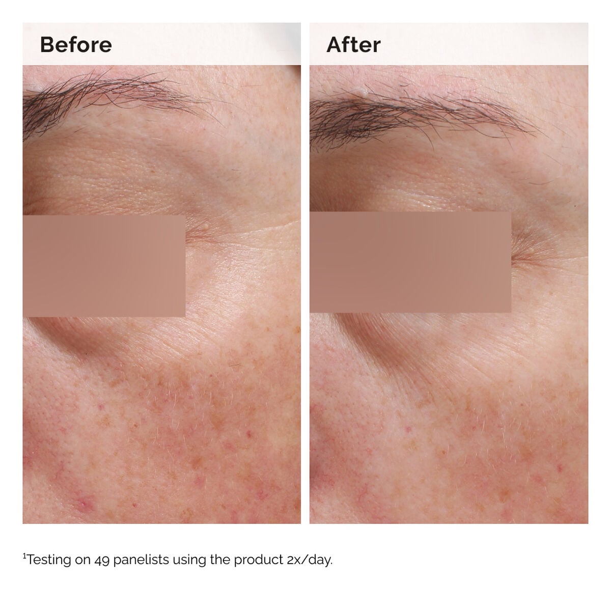 niacinamide-5-face-and-body-emulsion-e1 2024-08-23-ORD-Nia-5pct-Face-Body-B-A-Elasticity-Global-02-1x1.jpg