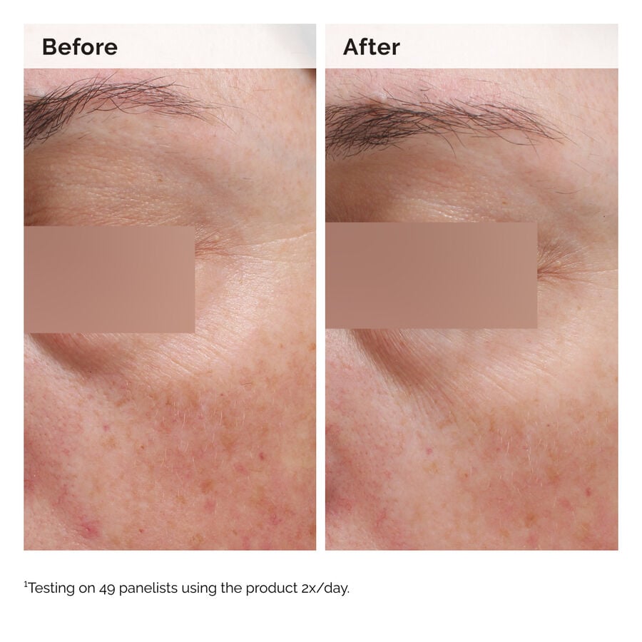 niacinamide-5-face-and-body-emulsion-e1 2024-08-23-ORD-Nia-5pct-Face-Body-B-A-Elasticity-Global-02-1x1.jpg