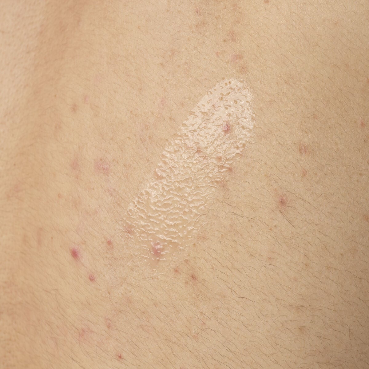salicylic-acid-0-5-body-serum-u9 ORD-salicylic-acid-05-body-240ml-application.jpg