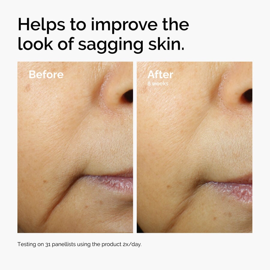 caffeine-3-escin-1-face-serum-t3 ord-caffeine-3pct-escin-1pct-face-serum-before-after-sagging.jpg