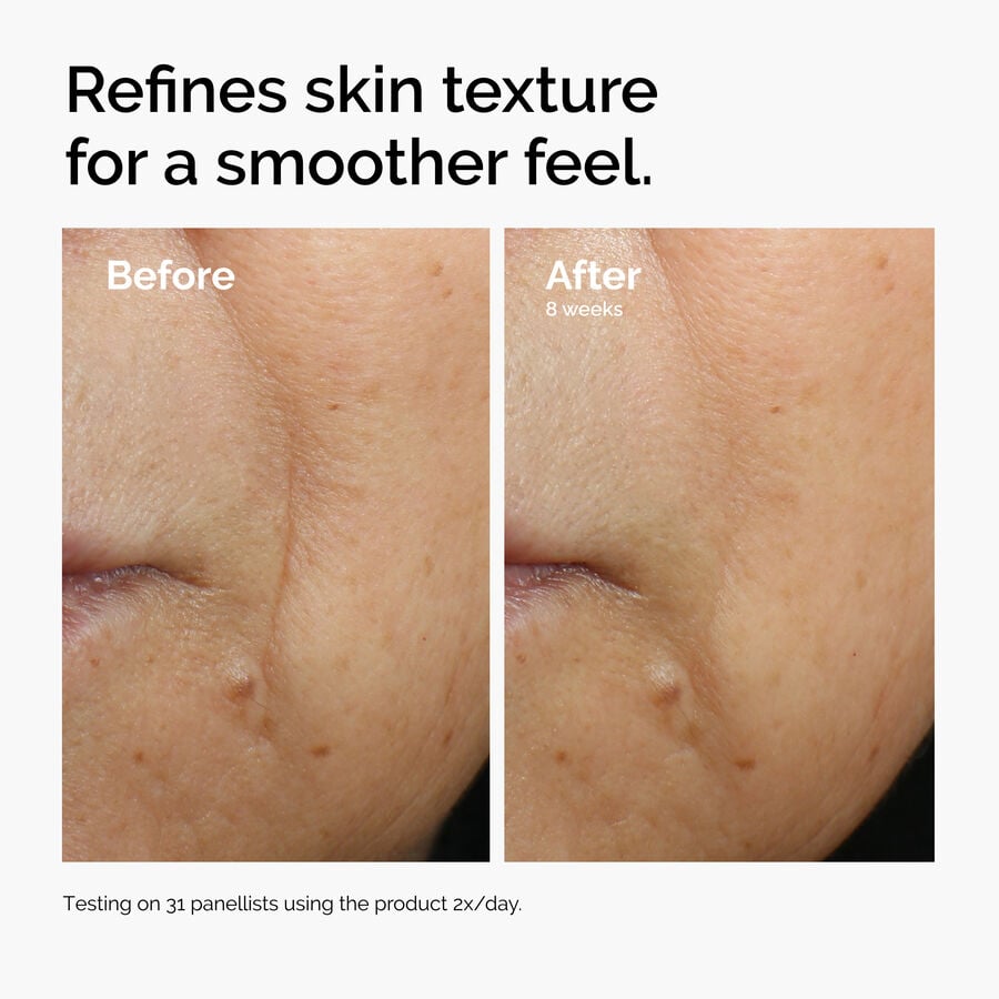 caffeine-3-escin-1-face-serum-d7 ord-caffeine-3pct-escin-1pct-face-serum-before-after-texture.jpg