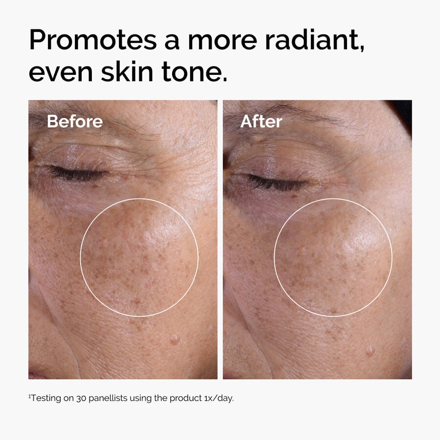 glycolic-acid-7-exfoliating-toner-v3 ord-glycolic-before-after-radiance.jpg
