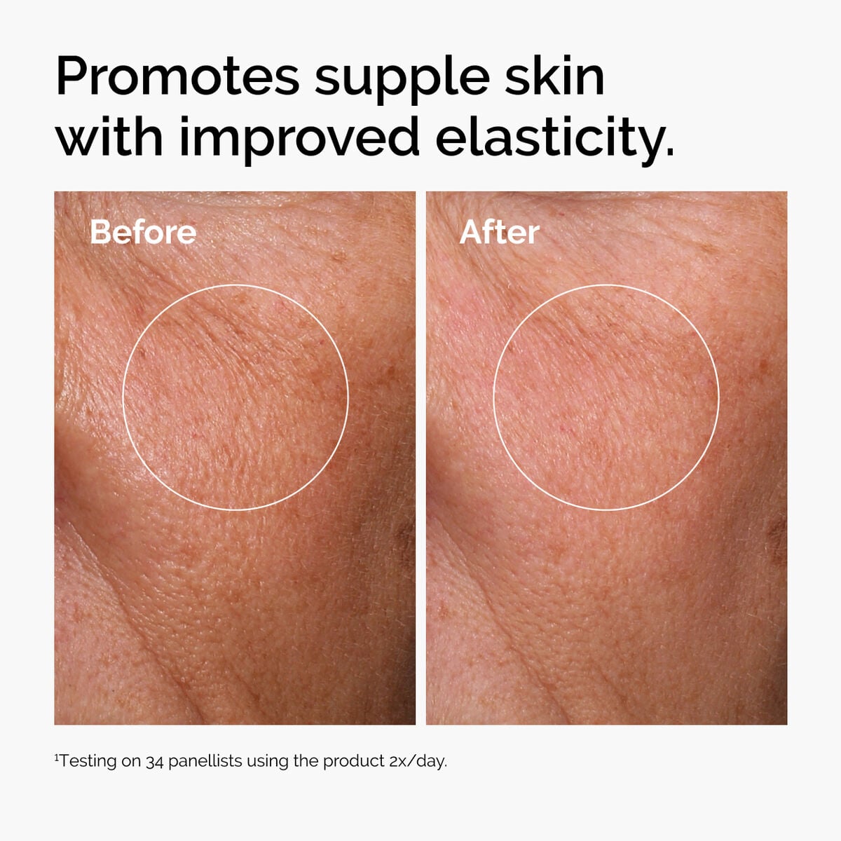 hyaluronic-acid-2-b5-with-ceramides-q1 ord-hyaluronic-acid-2pct-b5-hydrating-serum-before-after-elasticity.jpg