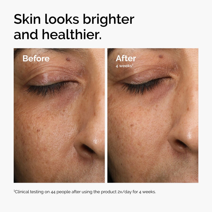 multi-antioxidant-radiance-serum-s1 ord-mars-before-after-healthy.jpg
