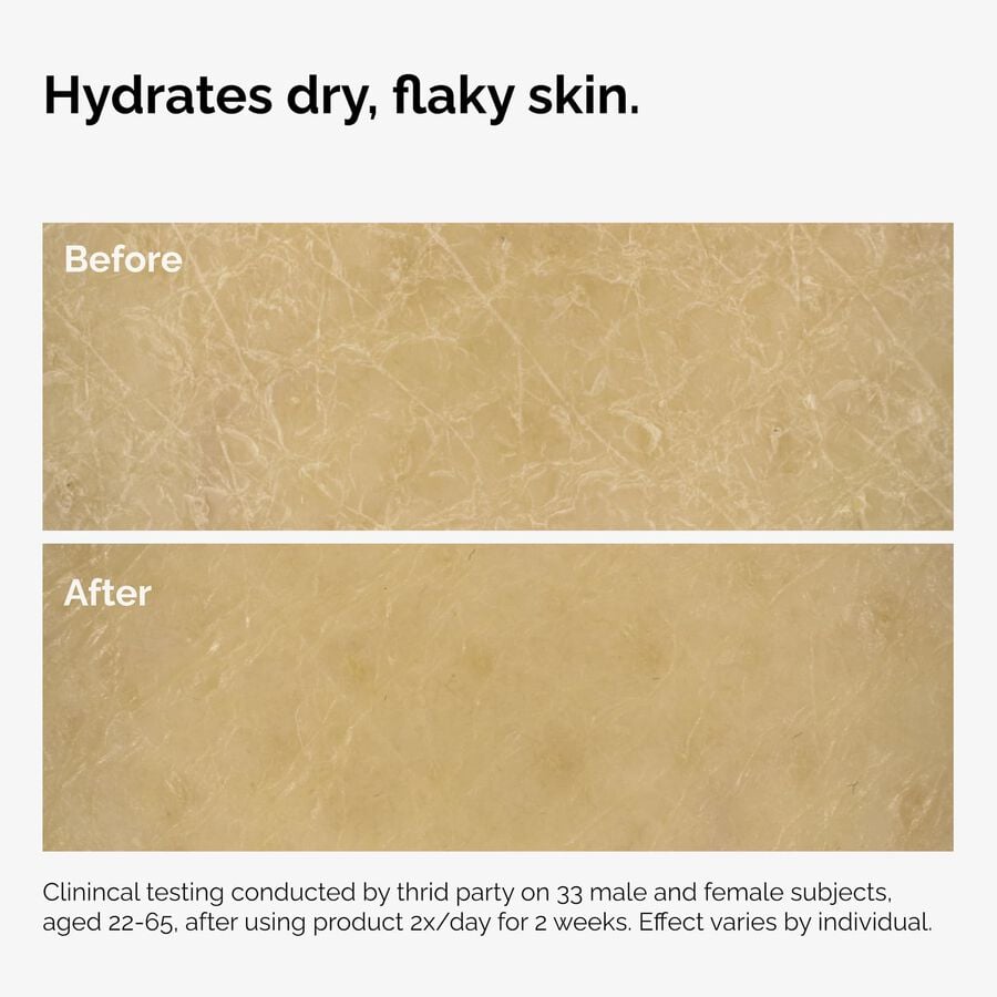 the-body-care-collection-e2 ord-natural-moisturizing-factors-inulin-body-before-after-graphic-02.jpg