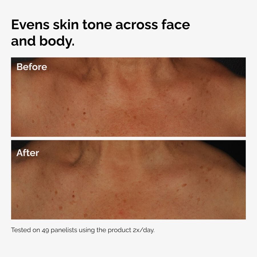 the-body-care-collection-e2 ord-niacinamide-face-body-serum-before-after-even-tone-graphic.jpg