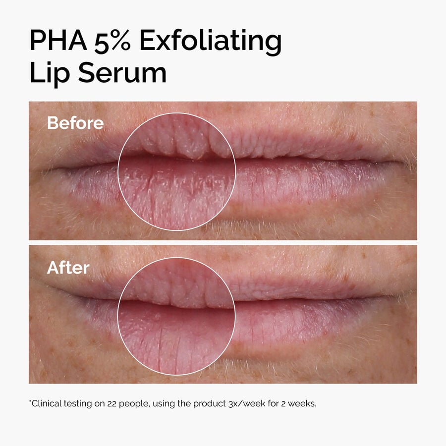 pha-5-exfoliating-lip-serum-q7 ord-pha-5pct-lip-exfoliating-serum-before-after.jpg