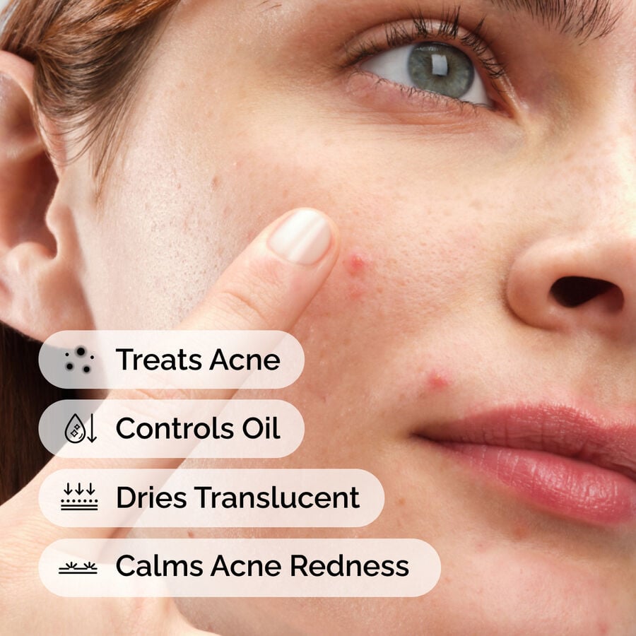 sulfur-10-powder-to-cream-concentrate-l6 ord-sulfur-10pct-powder-to-cream-concentrate-model-application-with-benefits-acne.jpg